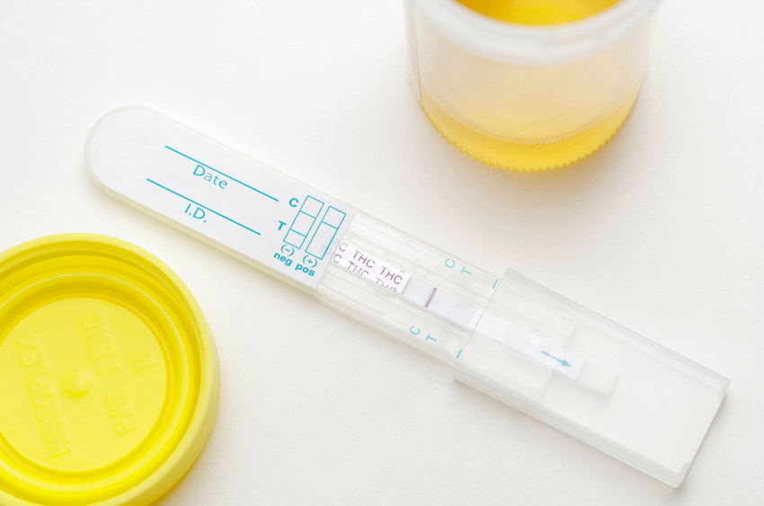 cbd test drogas dgt